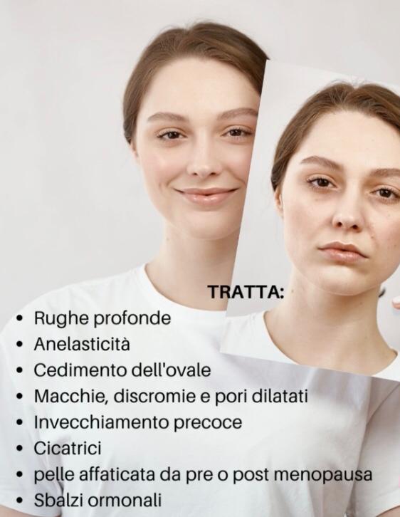 Trattamento Pelli Esigenti Centro Estetico Gavardo Brescia Very Well Veronica Bresciani